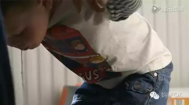 父母不过敏孩子怎么会过敏,皮肤过敏怎么治反复过敏