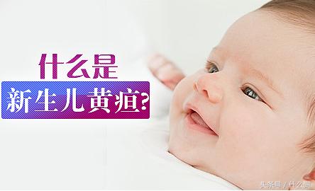 新生儿黄疸11需要吃退黄疸的药吗,新生儿头部黄疸和身上黄疸不一样