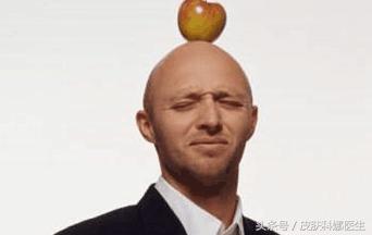 鬼剃头或者斑秃会反复发作吗,鬼剃头斑秃怎么办