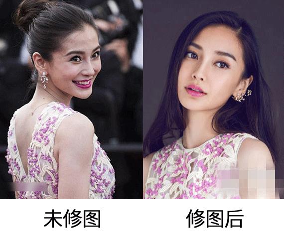 赵丽颖黑头怎么去掉,赵丽颖黑头去除方法