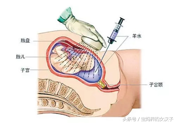 孕期一定要做这些检查,孕期最危险的事