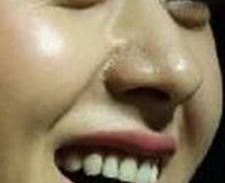 赵丽颖黑头怎么去掉,赵丽颖黑头去除方法