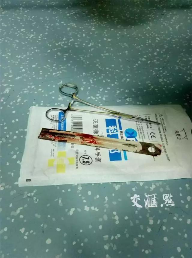 X光片里的体内异物，简直大开眼界