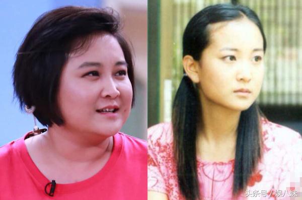 为减肥只吃菜不吃饭,贾玲为了减肥打瘦脸针