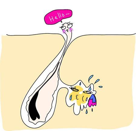 为什么我们喜欢挤痘,挤痘痘到底有多可怕