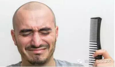 头顶稀疏发缝宽脂溢性脱发怎么办,前额头顶脱发稀疏细软怎样办