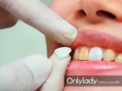 希拉里牙齿怎么样,希拉里的女儿怎么样