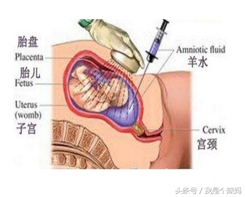 关于胎儿性别的鉴定，到底哪种准确率高一些，哪种失误率更大？
