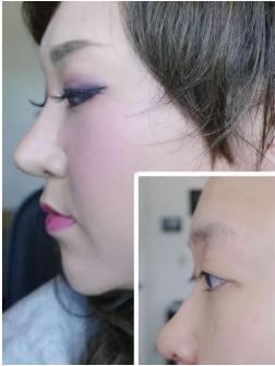 痱子粉也能隆鼻啊？看完给跪了