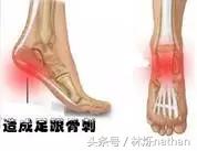 初学者怎么练好高跟鞋,高跟鞋矫正