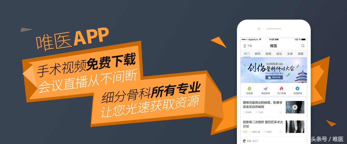 膝关节内侧后角半月板1度损伤,右膝关节内侧半月板后角变性损伤