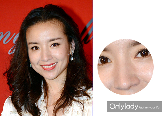 女子花4万块整容把嘴都整歪了,美国女子花76万整容