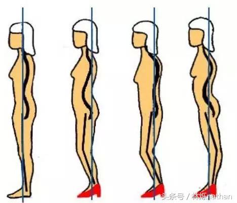 初学者怎么练好高跟鞋,高跟鞋矫正