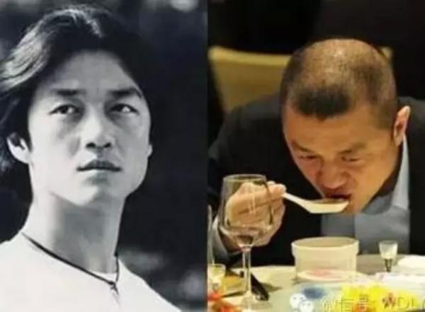 脱发的困扰和治疗方法,脱发困扰怎么缓解心情