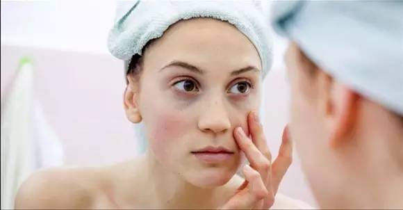 脸部水肿怎么消肿最快方法,脸部和眼睛水肿怎么办