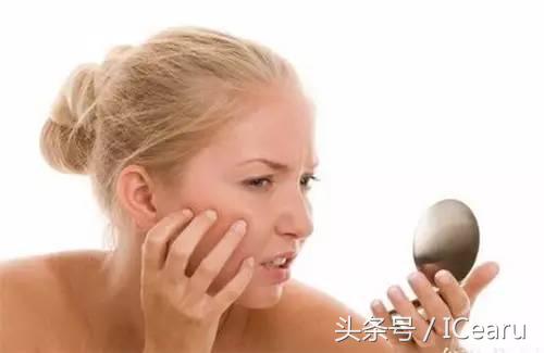 脸颊下巴祛痘有效方法,最实用的脸部祛痘方法