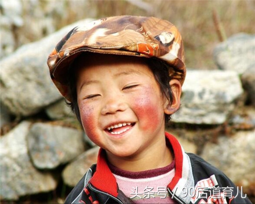 宝宝高原红的脸用什么修复,宝宝一到秋冬季就大红脸