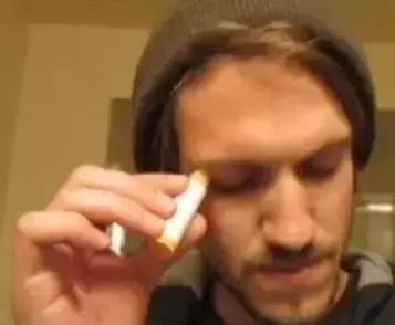 把风油精滴在眼睛里会疼吗,把风油精擦在眼眸上