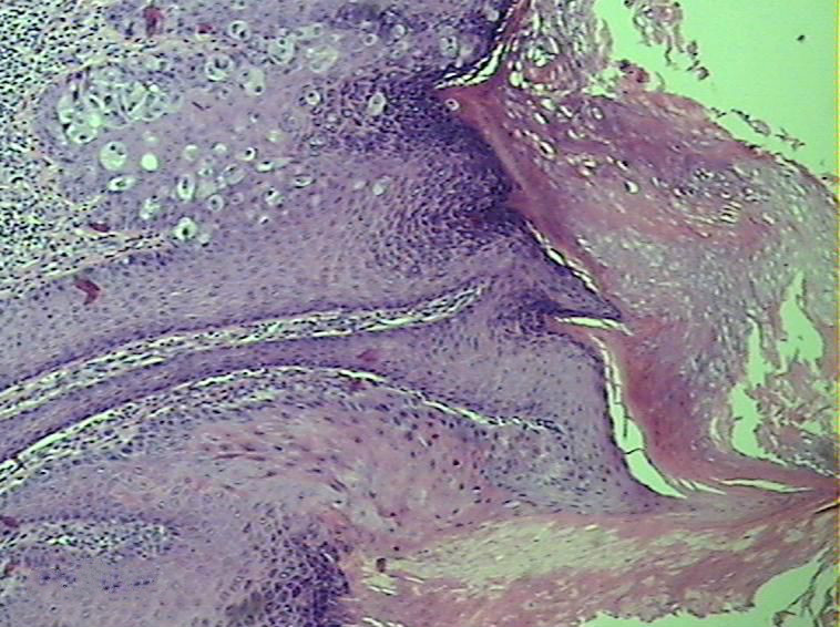 睾丸瘙痒是湿疹吗,睾丸瘙痒是真菌感染还是湿疹