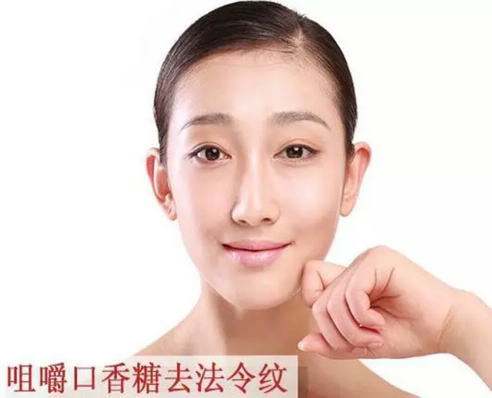 玻尿酸去除法令纹,一招教你去除法令纹