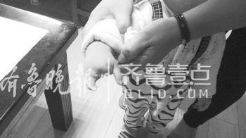 孩子生下缺仨指头家属状告医院院方称产检B超有局限无过错