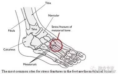 脚踝疼痛做什么检查比较准确,脚踝疼痛自查方法
