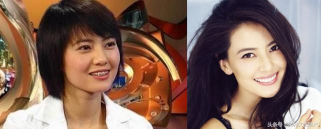 林允整牙效果怎么样,林允整牙后变化图片