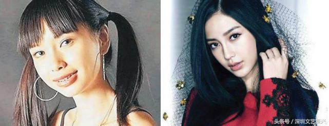 林允整牙效果怎么样,林允整牙后变化图片