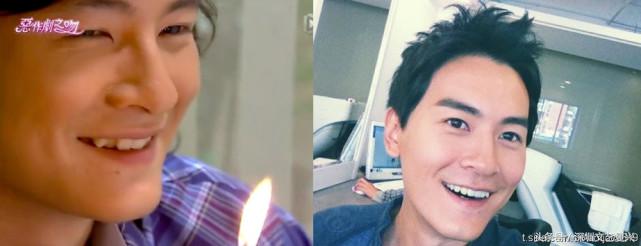 林允整牙效果怎么样,林允整牙后变化图片