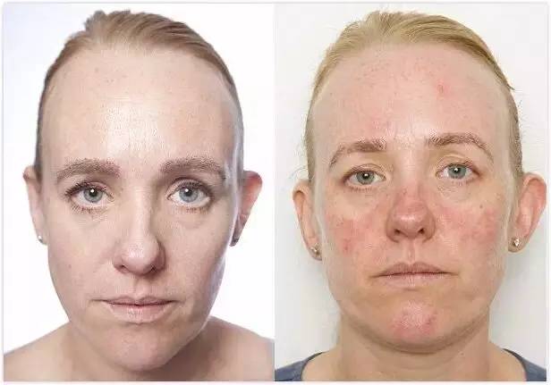 编辑朋友圈｜卸妆不彻底，2万块的精华都救不了你的脸！