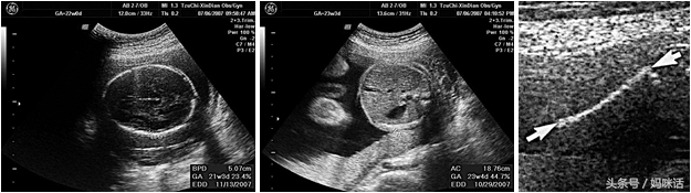 怀孕宝典软件哪个好用,怀孕宝典哪个好