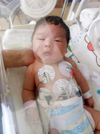 顺产还是剖宫产到底怎么选,怎么选择正确的分娩方式