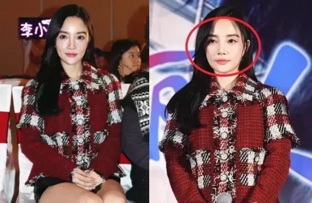 整牙=整容?看杨幂、刘涛、高圆圆为你亲身示范!