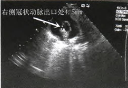 儿童发热不及时就诊会有什么后果,儿童不明原因发烧不退