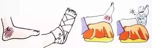 打球老是崴脚是动作不对吗,打球崴脚了怎么避免习惯性崴脚