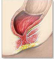 医生开玩笑对怀孕的护士说“你生孩子没*眼屁**！”，没想到一语成谶
