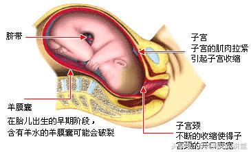 产妇自然分娩有几个产程,分娩第一天产妇注意什么