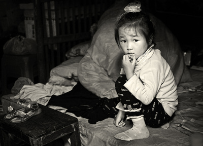 小孩头发长满了虱子,老人小孩头上长满虱子原因