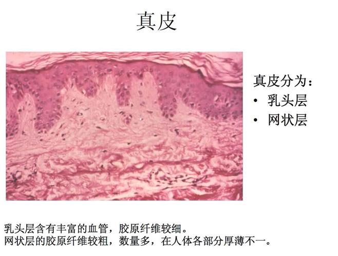 微针治痘坑涂碘伏,微针对深痘坑有效吗