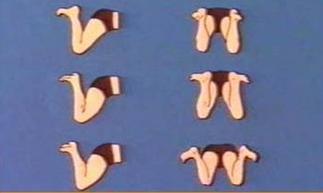 蛙泳治疗腰椎间盘突出,蛙泳能治好腰间盘突出吗