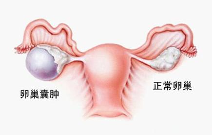 女性怀不了孕的各种原因分析,女人怀不了孕查哪一项