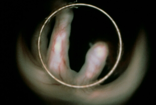 怎么才能怀上双黄的蛋,怀孕初期的鸡要怎么做才有营养