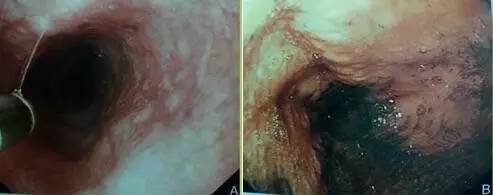 卢戈氏碘液，低身价，大用途