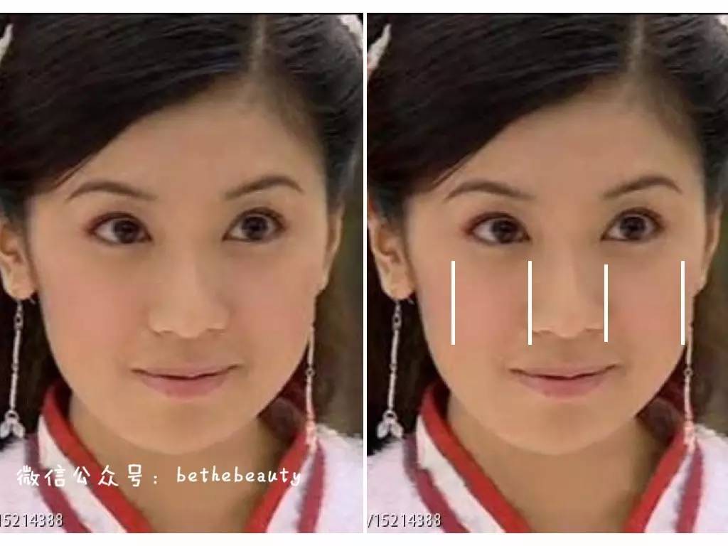 鼻子除了整容变挺还有什么办法,不想整容怎么让鼻子好看