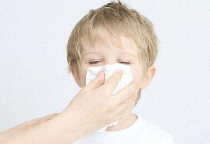 宝宝过敏性鼻炎的治疗方法小妙招,宝宝过敏性鼻炎中医怎么治疗好呢