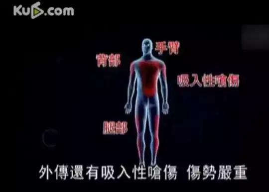 烧伤事件双方粉丝互撕六年，他们承受无尽痛苦，却总是被揭旧伤疤