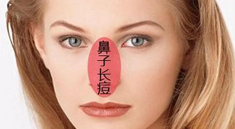 8张图让你秒懂长痘的原因,原来这才是长痘的真实原因