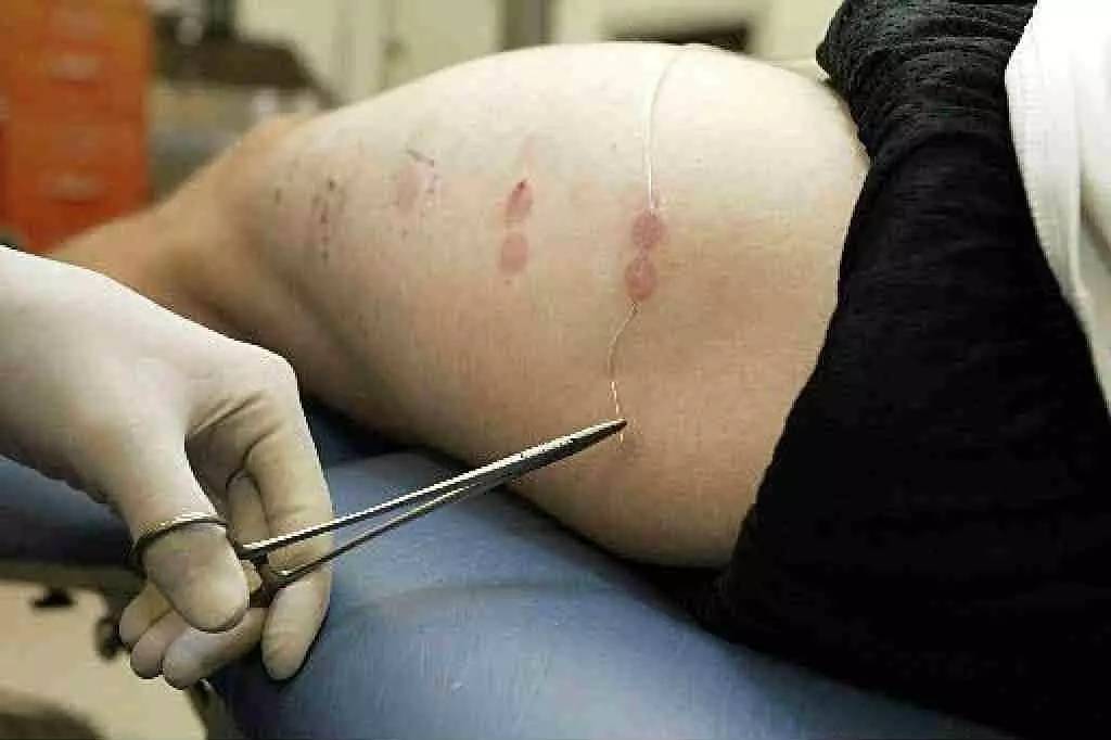 疼痛机制大揭秘,痛感检测