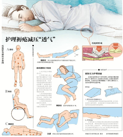 褥疮易缠身防患于未然