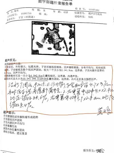 双侧卵巢囊肿剥离术后6年又复发，保守治疗后左侧缩小88.6%